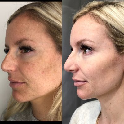 7E1298FC-006A-4C90-822E-2F21CC5CD15F