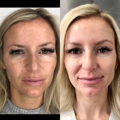 D00138E9-D53F-4167-8DCA-9410254E2538