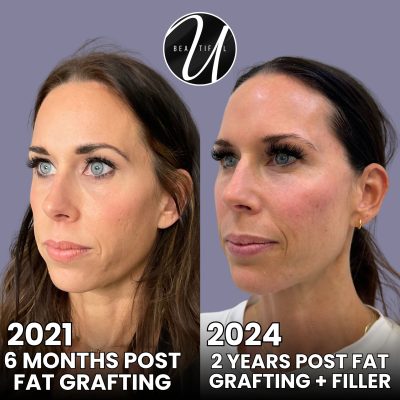 xr:d:DAF9XiKSbCg:47,j:3497469361281054964,t:24040818