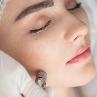 Diamond Facial also known as Microdermabrasion procedure at Beautiful U Medspa